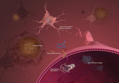 A neuronok közötti kapcsolatok megszűnnek